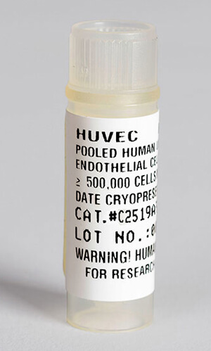 ԭĚo}(ni)Ƥ(x)B(yng) Human Umbilical Vein Endothelial Cells MediumLONZAԭ(x)Їһ